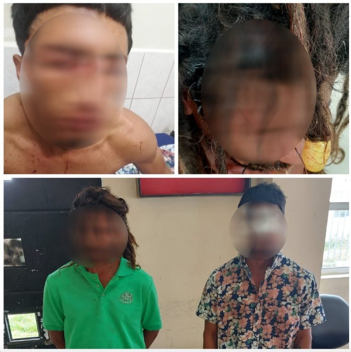 RIÑA. Dos hombres resultaron gravemente heridos al enfrentarse en una pelea en un barrio de Tonsupa, cantón Atacames. RIÑA. Dos hombres resultaron gravemente heridos al enfrentarse en una pelea en un barrio de Tonsupa, cantón Atacames.